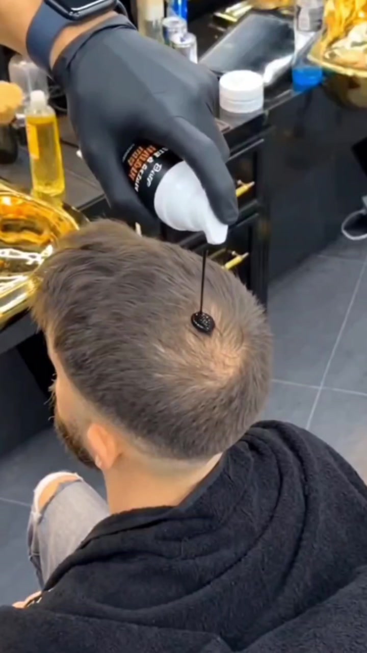 Video 4 of 6: demonstration of the concealer being applied to thinning areas.