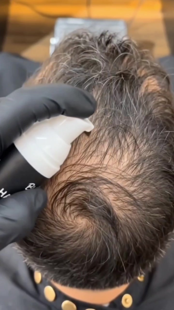 Video 5 of 6: demonstration of the concealer being applied to thinning areas.
