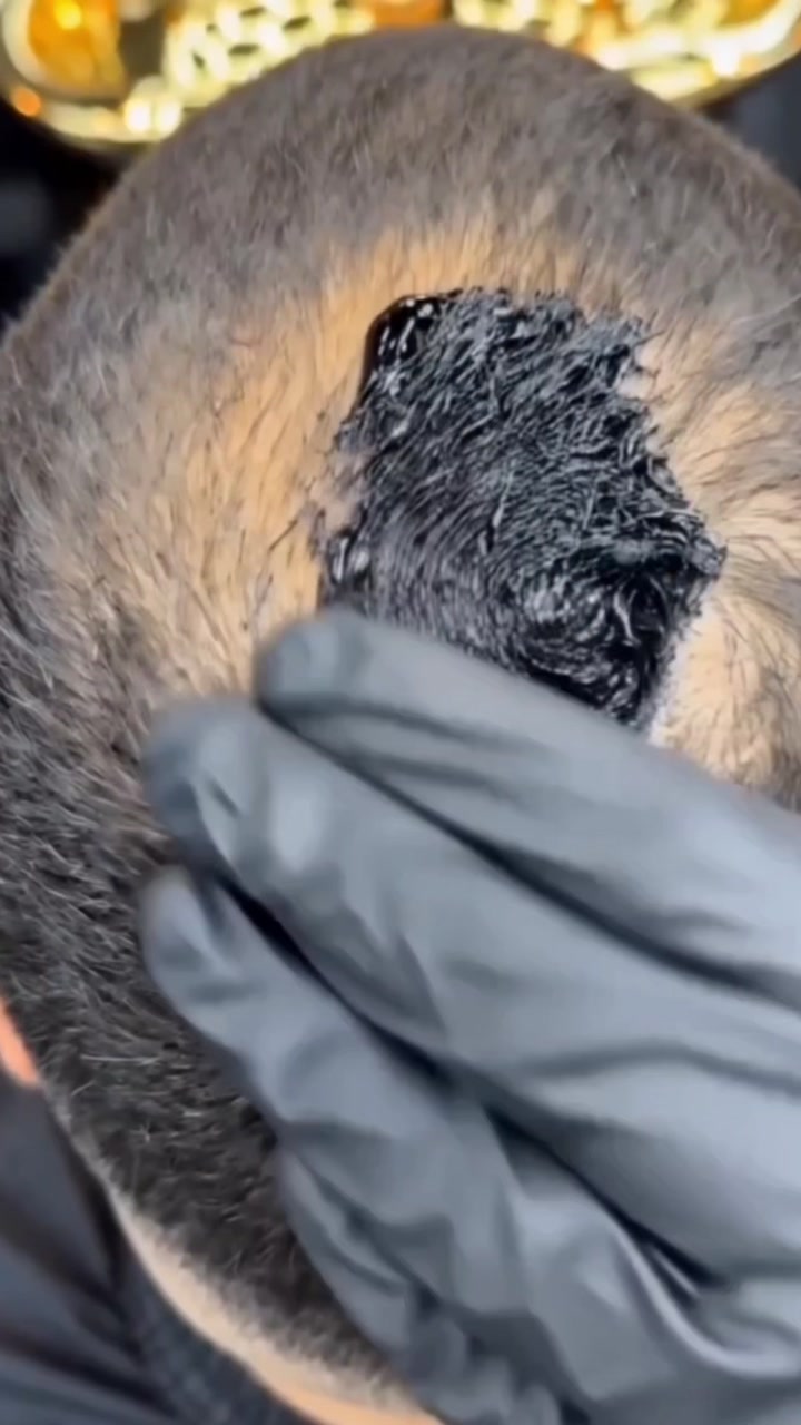 Video 6 of 6: demonstration of the concealer being applied to thinning areas.